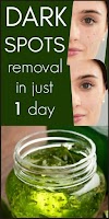 I Got Shocked With The Results Of This Magical Remedy, It Removed Dark Spot In 1 Day