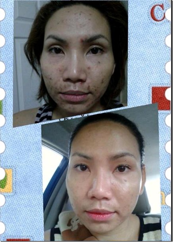 1_Serum testimonial.amazing results