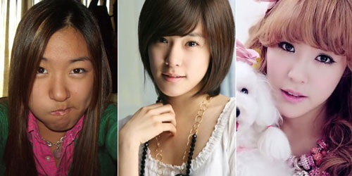 Tiffany SNSD Operasi Plastik