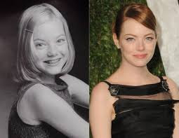 Rare Unseen Childhood Photos of Hollywood Actress Emma Stone