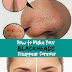 How to Make Your Blackheads Disappear forever 