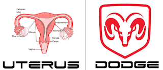 dodge uterus