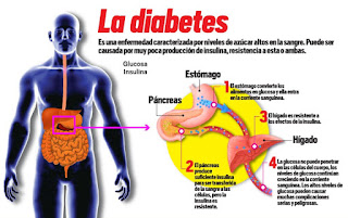 QUÉ ES LA DIABETES