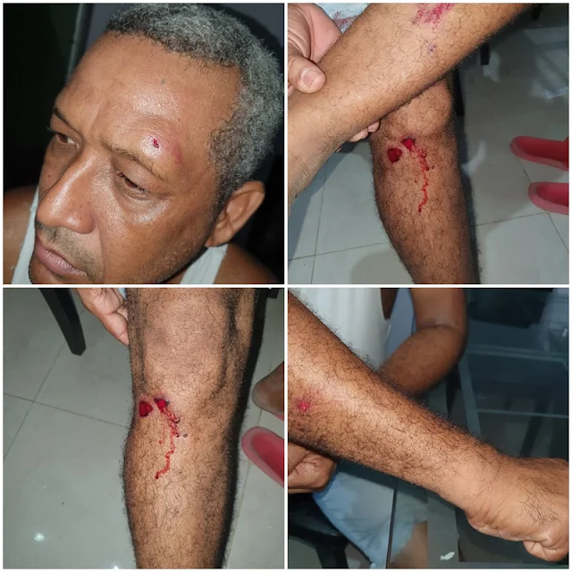 Agredido Fiscal de Asodegua y su hijo por el ESMAD en Riohacha