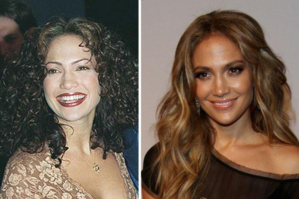 Jennifer Lopez Celebrity Plastic Surgery 