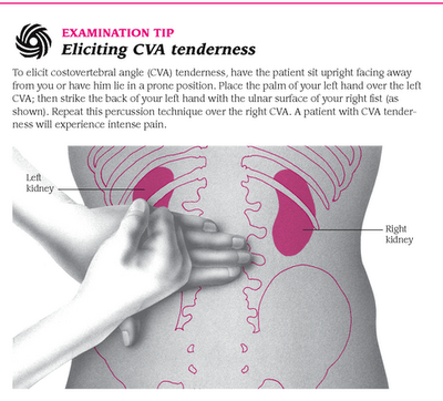 referred abdominal pain. Pain in the costovertebral