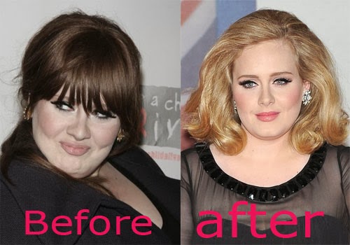 Good Plastic Surgery Before And After: Adele Nose Job Before and ...