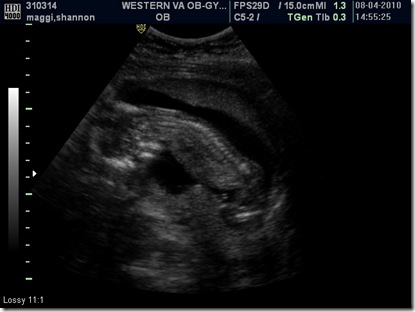 BABY_2