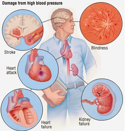 Tips to Control Blood Pressure