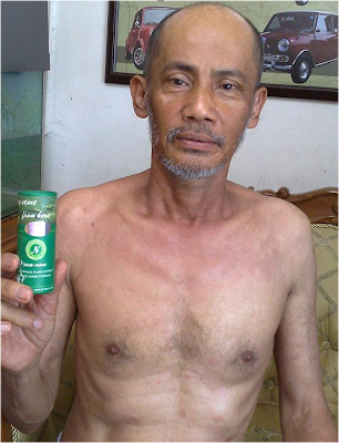 Enzyme Noni Mengkudu  Cancer  Stroke  Diabetes  High 