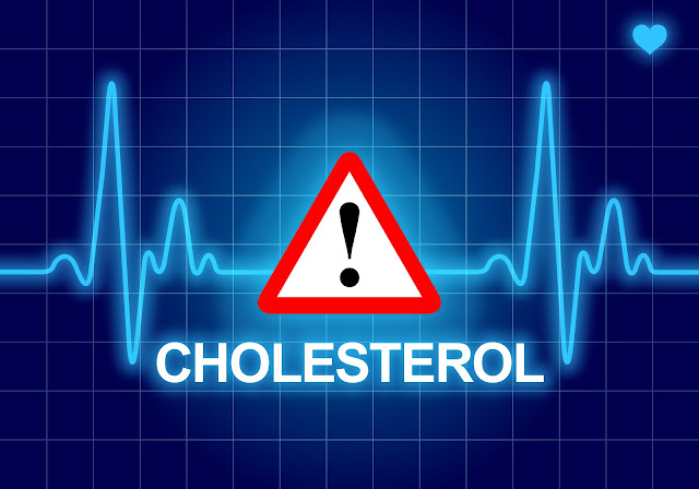 blood test for cholesterol in Carshalton