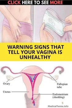 5 Warning Signs That Your Vagina is Unhealthy