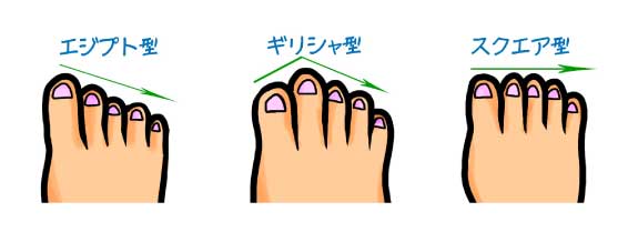 日本人の代表的な足型を表したイラスト。詳細は後述。
