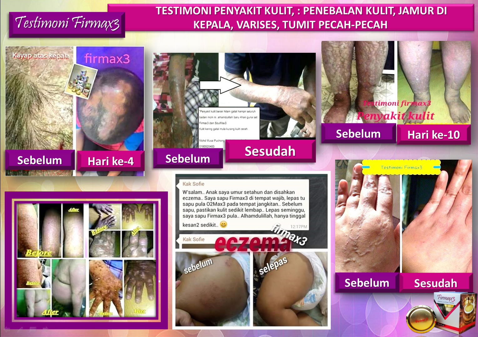 Testimoni Firmax3 Cream Indonesia