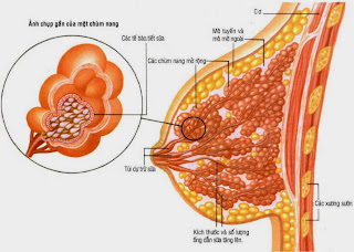 BỊ TẮC SỮA PHẢI LÀM SAO