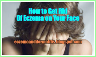 How to Get Rid Of Eczema on Your Face