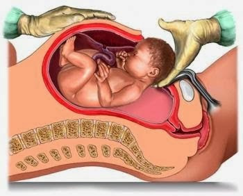 Diagram pembedahan czer