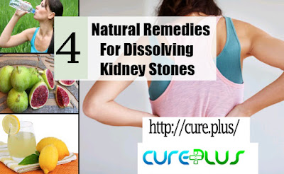 natural Remedies to Dissolve Kidney Stones-cureplus