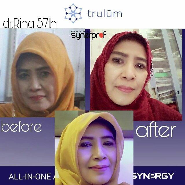 Jual Trulum Skincare Synergy Di Area Fef, Tambrauw WA: 08112338376