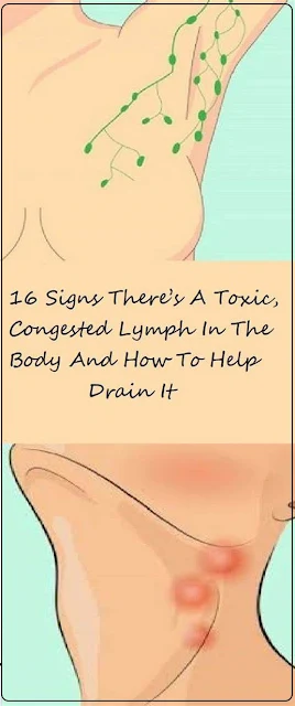 16 Signs There’s A Toxic, Congested Lymph In The Body And How To Help Drain It