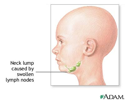 nodes in neck. Neck Nodes