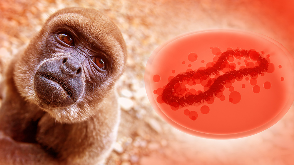 WHO investigating reports of monkeypox virus in semen