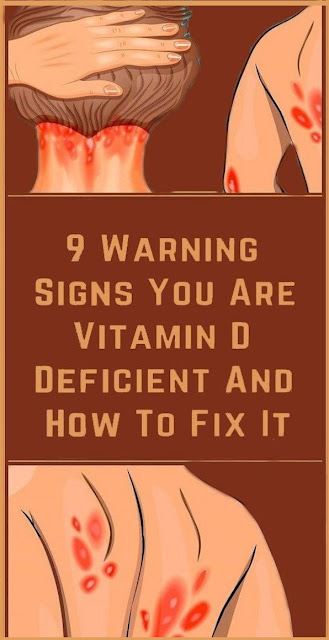 9 Signs That Could Mean You’re Not Getting Enough Vitamin D