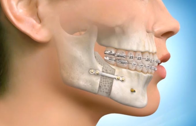 How to Have the Best Experience of Orthodontic Treatment in NCR