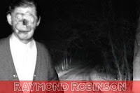 Raymond Robinson: Sosok Pria Tanpa Wajah yang Menginspirasi Urband Legend "Charlie No Face"