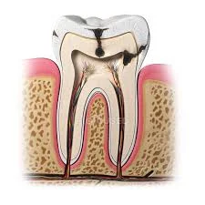 tooth pathology