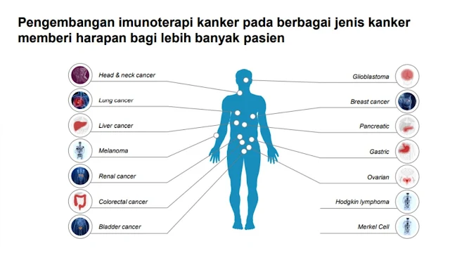 imunoterapi-pengobatan-kanker-hati