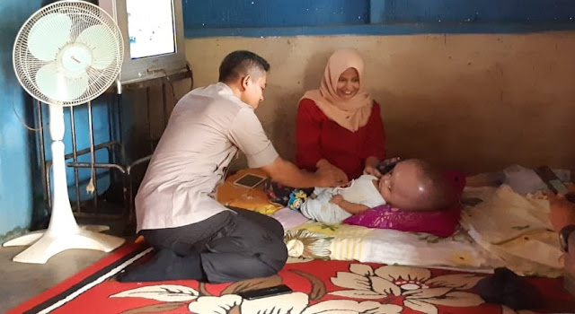 Kapolres Lampung Utara Sambangi Balita Pengidap Penyakit Hydrocephalus