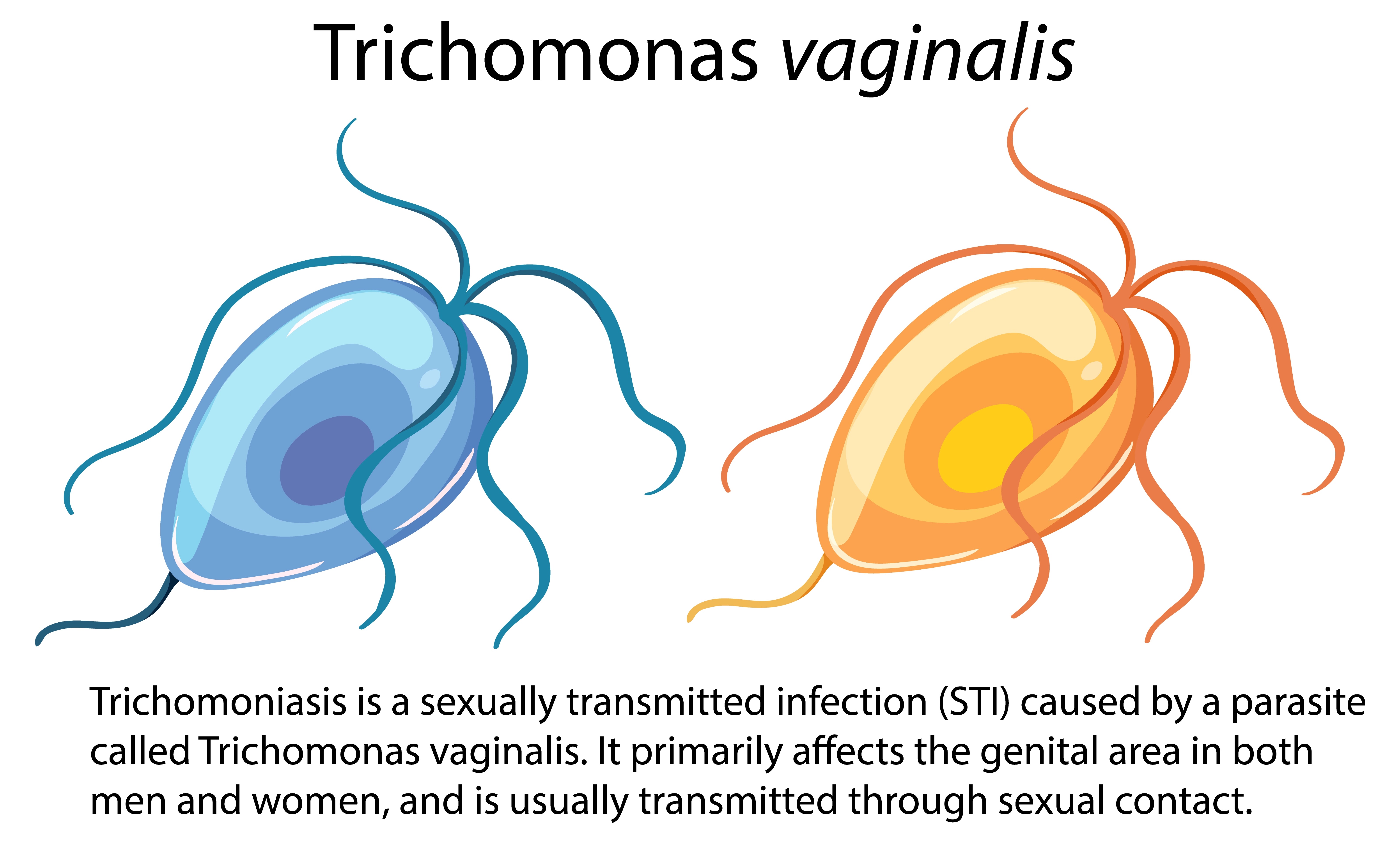 Trichomoniasis Vaginalis