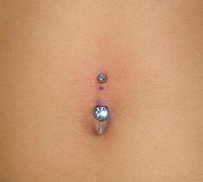 migrated navel piercing. Naval Piercing