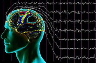 EEG di ICU: Kunci untuk Mendeteksi Kesadaran yang Samar-Samar