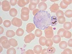 Plasmodium Malaria