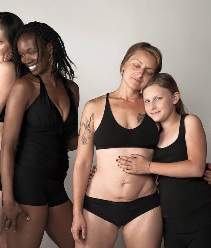 A Photographer Shows How Female Bodies Truly Look Like After Pregnancy