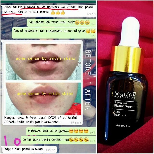 Satin Skinz Facial Acne Cream / Acne Serum Murah