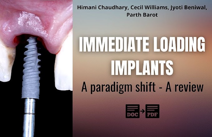 PDF: Immediate Loading Implants - A paradigm shift: A review