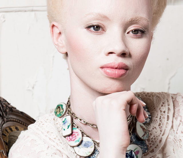 Image result for female nigerian albino