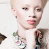 Health Hazard of Albinism 