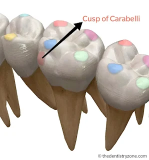 Cusp of Carabelli