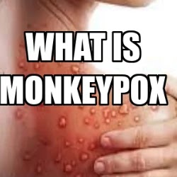 monkeypox. The form of monkeypox on an infected person
