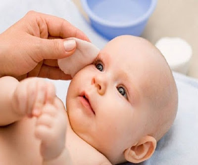 Các bệnh về mắt ở trẻ sơ sinh - Bệnh tắc tuyến lệ phổ biến 