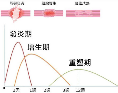 #腳踝扭傷 #腳踝扭傷怎麼辦 #腳踝扭傷後遺症 #腳踝痛 #腳踝韌帶 #腳踝韌帶斷裂 #腳踝韌帶撕裂 #再生 #修復 #PRP #血小板