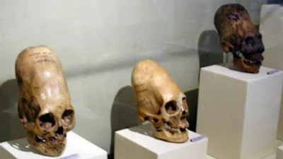 DNA from ancient elongated skulls prove they are not fully human.