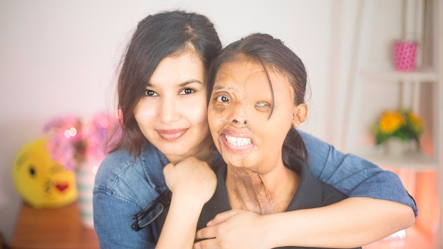 shabbo sheikh acid attack survivor