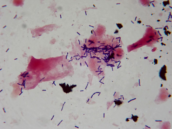 staphylococcus aureus gram stain. Normal vaginal gram stain