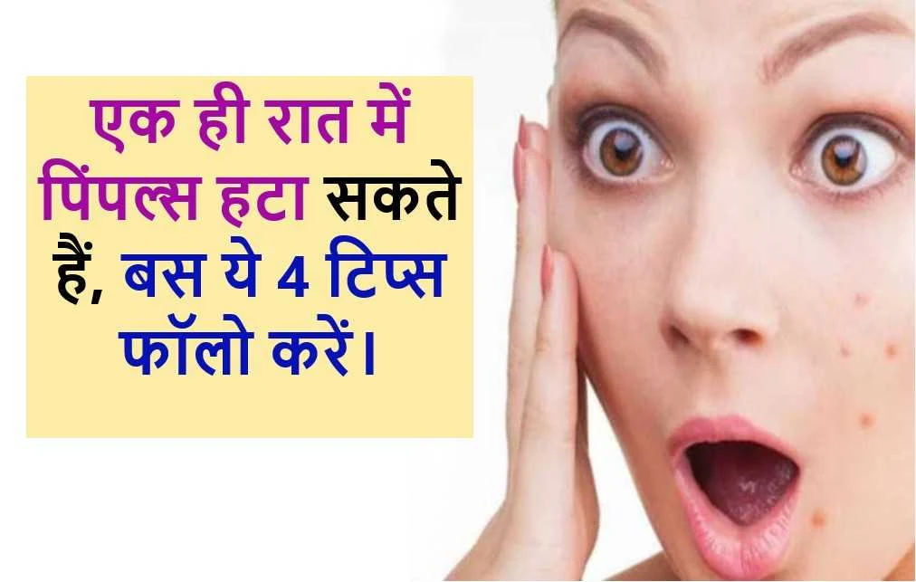 1 दिन में पिंपल हटाने का घरेलू उपाय