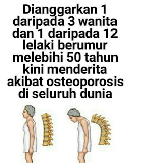 tulang rapuh, sakit tulang rapuh, osteoporosis, Pengedar shaklee johor, p[engedar ostematrix johor, pengedar ostematrix shaklee